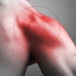 rotator cuff tear exercises android application logo